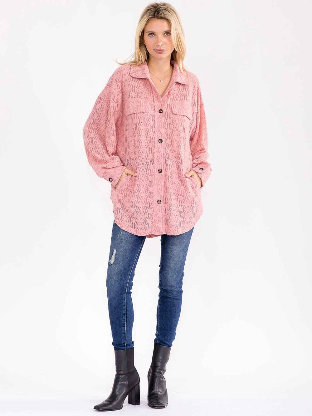 BIBI Oversized Lace Shacket – Pink or Blue